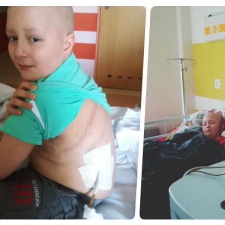 "Dramat dziecka na onkologii". Trwa zbiórka funduszy na leczenie 10-letniego Krzysia